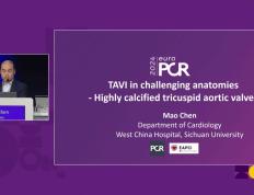 EuroPCR 2024｜陈茂教授：高度钙化的三叶式主动脉瓣狭窄患者行TAVI面临的挑战