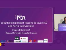 EuroPCR 2024｜女性患者重度主动脉瓣狭窄和主动脉瓣介入治疗的当代洞察