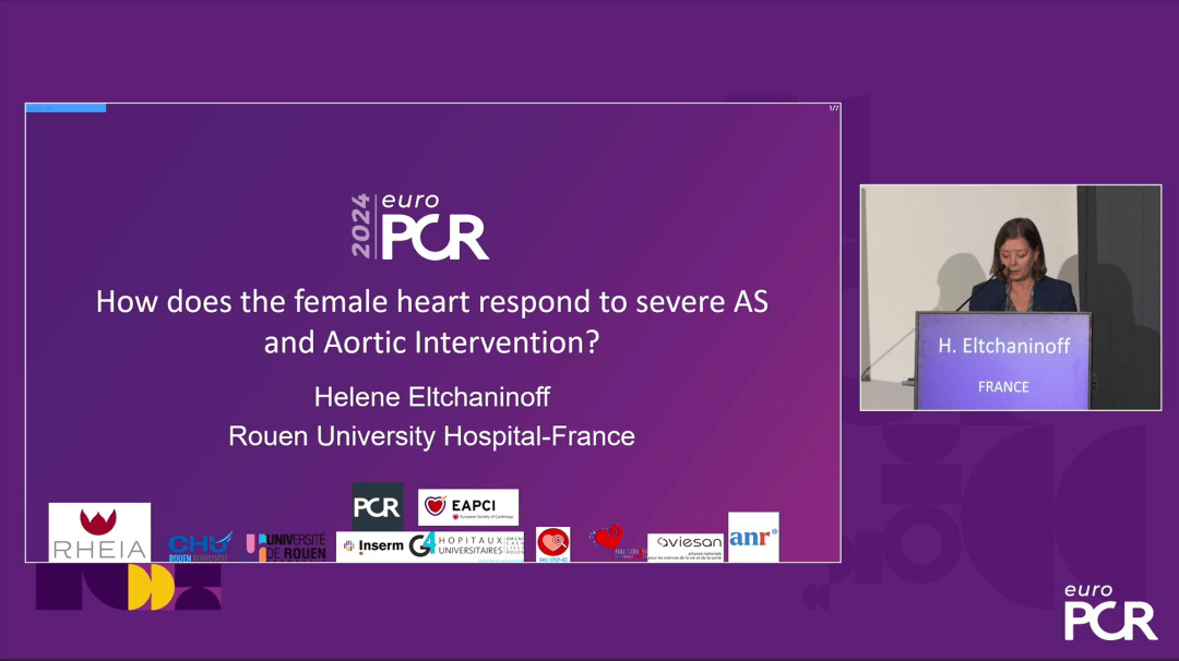 EuroPCR 2024｜女性患者重度主动脉瓣狭窄和主动脉瓣介入治疗的当代洞察