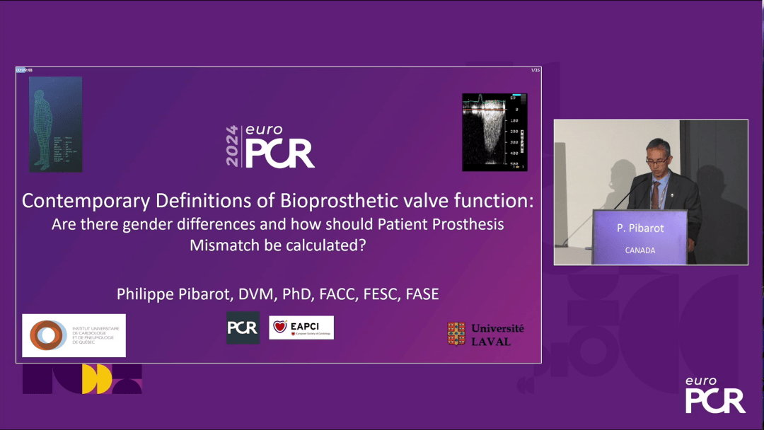 EuroPCR 2024｜女性患者重度主动脉瓣狭窄和主动脉瓣介入治疗的当代洞察