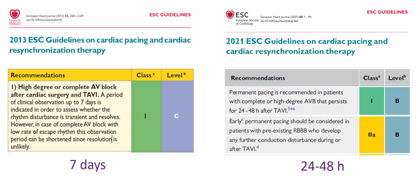 EuroPCR 2024｜宋光远教授：TAVI术后传导阻滞患者应用过渡起搏器可减少不必要永久起搏器植入