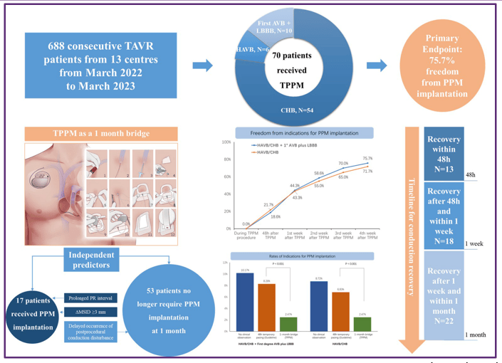 EuroPCR 2024｜宋光远教授：TAVI术后传导阻滞患者应用过渡起搏器可减少不必要永久起搏器植入
