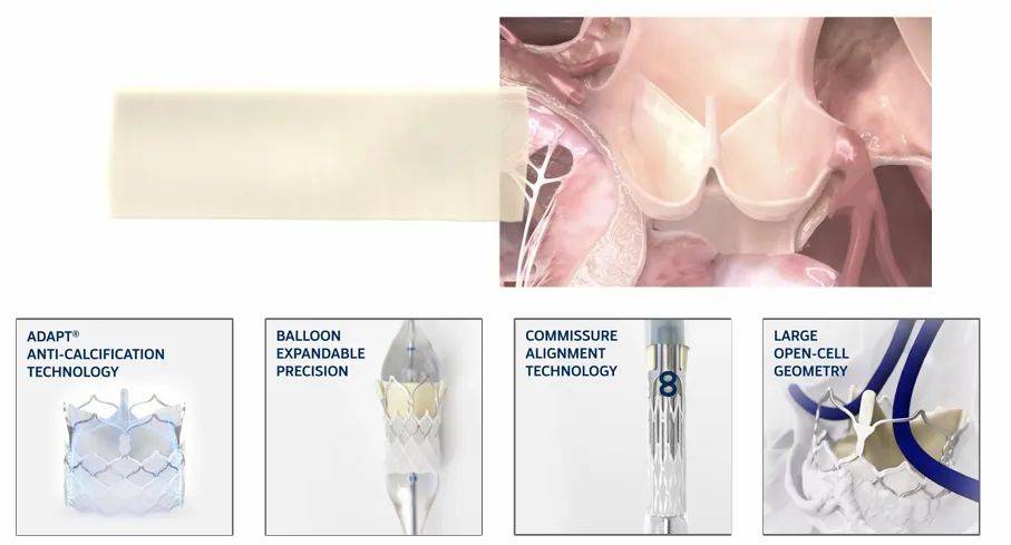 Euro PCR 2024｜仿生经导管主动脉瓣膜（DurAVR）首次对人试验和早期可行性试验再添佳绩